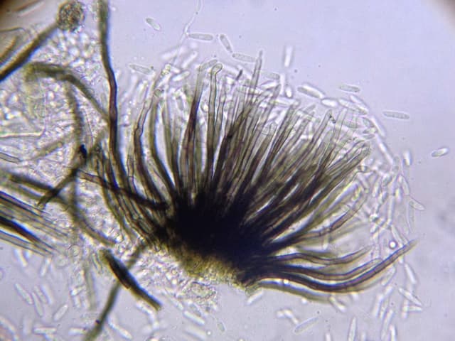 Microscopia de Colletotrichum causante de antracnosis